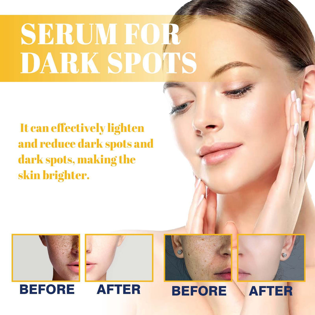 Whitening And Fading Spots Hydrating Facial Essence